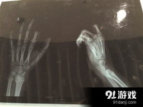 泡泡大作战游戏手机游戏 